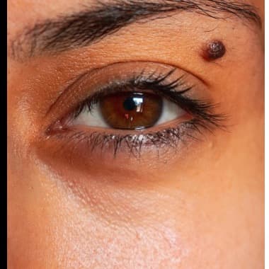 Social post thumbnail: How to treat dark circles under your eyes
