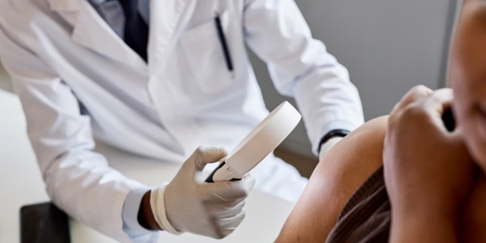 Social post thumbnail: Fungal Acne